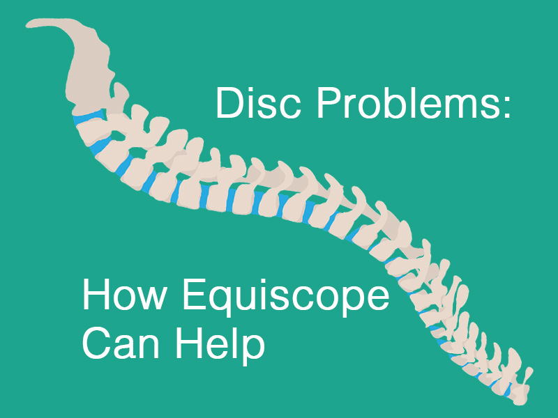 graphic of spine to illustrate disc problems