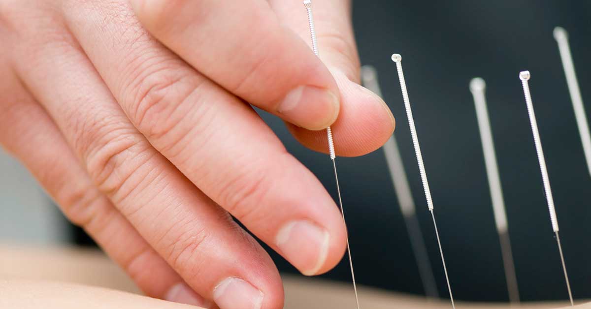 Acupuncture Points and Meridians: How They Support Our Body’s Healing
