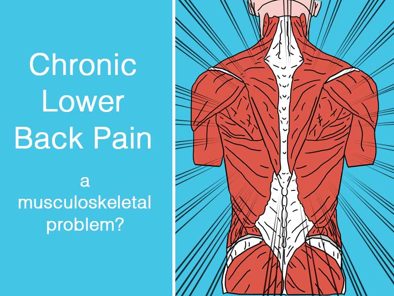 graphic of back muscles to illustrate chronic lower back pain