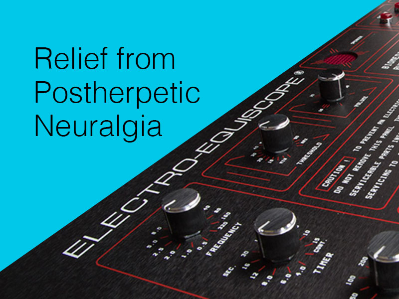close-up of part of the Electro-Equiscope device to illustrate postherpetic neuralgia therapy