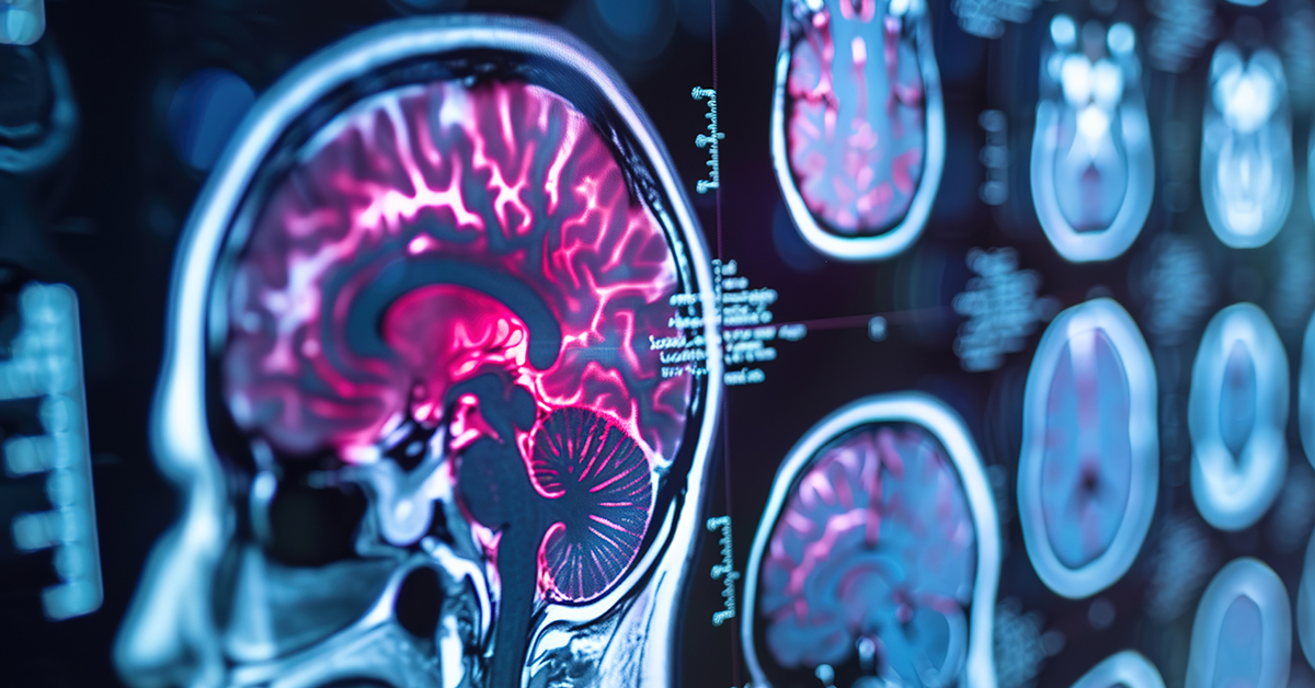 Rewiring Hope: Equiscope Protocols and a 12-Year-Old’s Remarkable Recovery from Grade 3 Diffuse Axonal Injury
