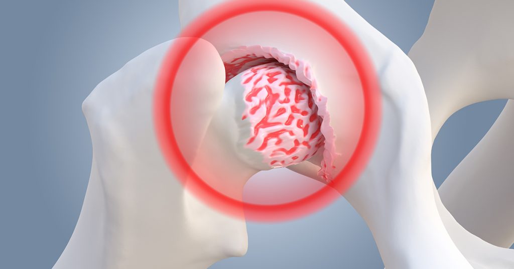 Relief in Motion: Managing Chronic Pain Through Equiscope