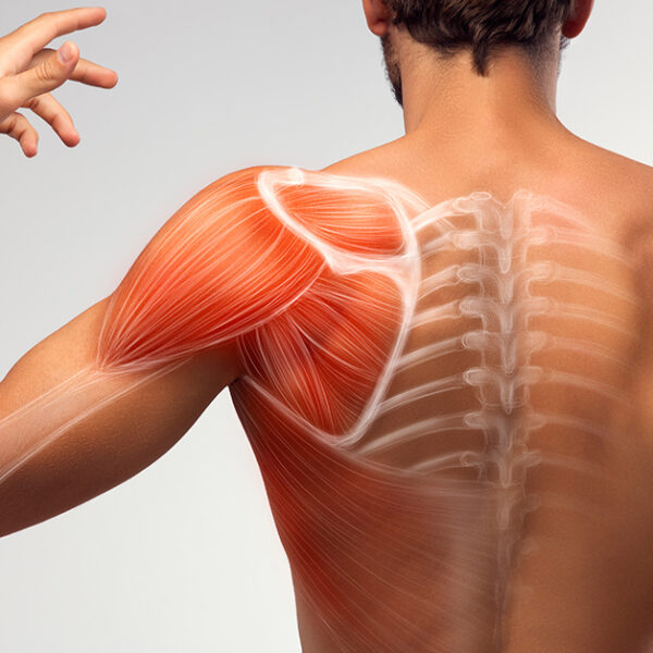 A Shoulder Revitalized: The Equiscope Protocol’s Role in Restoring Strength, Mobility, and Relief
